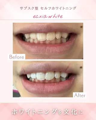 セルフホワイトニングエクシア天王寺店所属・セルフホワイトニング エクシア大阪天王寺店のその他イメージ