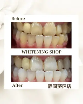 ホワイトニングショップ静岡葵区店所属・ホワイトニング ショップ葵区静岡駅店のその他イメージ