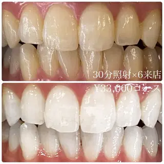 PLATINUM Beauty 横浜店所属・ホワイトニングルーム 横浜店のその他イメージ