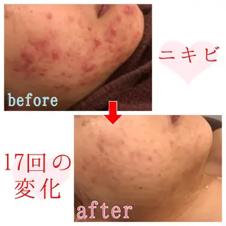 セミロング カラー パーマ ヘアアレンジ メンズ キッズ ネイル マツエク・マツパ 四つ星サロン🎖 腸＆ニキビケアに特化のエステ・リラクイメージ