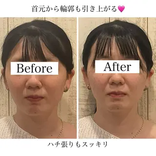 小顔矯正Speed KOGAO渋谷本店のエステ・リラクイメージ