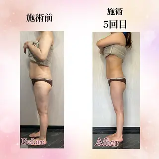 Total Beauty  ラトゥール所属・ラトゥール Maiのエステ・リラクイメージ