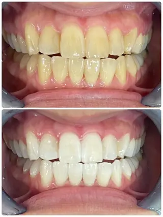 セルフホワイトニング エクシア徳島店マユのその他イメージ