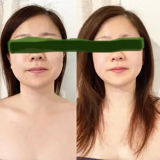 ロング マツエク・マツパ AKALA エステ リンパマッサージのエステ・リラクイメージ