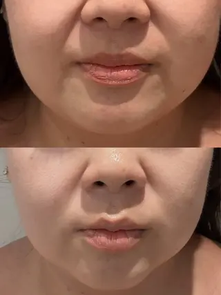 Hair&Spa リーノ所属・折原 あやのエステ・リラクイメージ