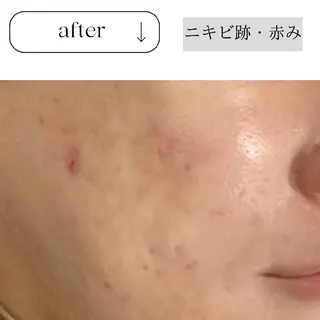 ICHOOSE/ 代々木上原のエステ・リラクイメージ