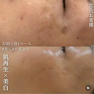 【福岡市西区 エステ】 GRANVIR(グランヴィール)所属・GRANVIR グランヴィールのエステ・リラクイメージ