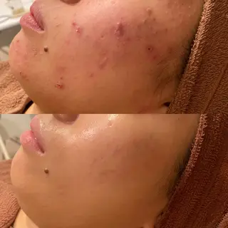 触れたくなる モテ肌へ...❤︎のエステ・リラクイメージ