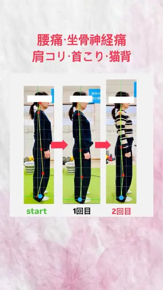 Arch整骨院所属・脳と関節から整える Arch整骨院のエステ・リラクイメージ