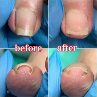 ネイル 巻き爪補正店　柏店所属・巻き爪補正店 柏店のその他イメージ