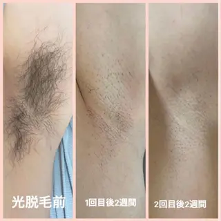 crescent所属・【韓国肌管理・脱毛】 クレセントのその他イメージ