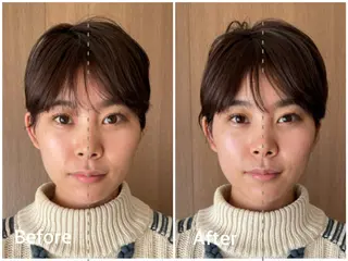 THE  ROOTS所属・美容鍼♡小顔矯正♡ fumikaのエステ・リラクイメージ