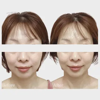 看護師 AYUIのエステ・リラクイメージ