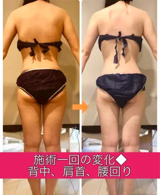 ロング カラー パーマ ヘアアレンジ メンズ キッズ ネイル マツエク・マツパ ‍痩身＆ボディ 結果出し🌟丹野のエステ・リラクイメージ