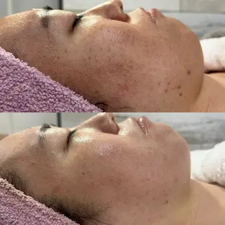 TotalSalon Briller所属・Nakashita Sayakaのエステ・リラクイメージ