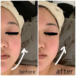 ビューティーサロンLEMO所属・ビューティーサロン Lemoのエステ・リラクイメージ