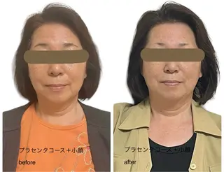 detoxサロン am.（アン.）のエステ・リラクイメージ