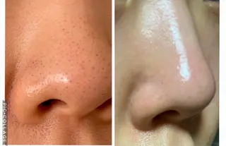 COLOR DESINGSALON所属・COLORDESI GNSALONのエステ・リラクイメージ