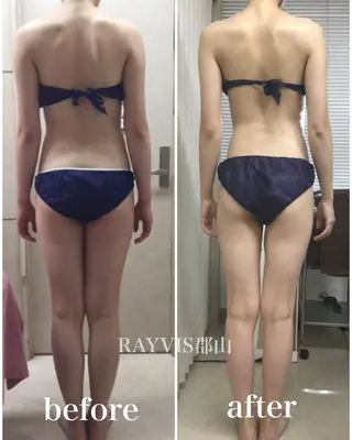 🩵RAYVIS🩵 郡山店のエステ・リラクイメージ