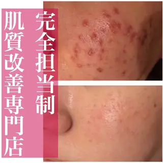 ミディアム カラー パーマ ヘアアレンジ メンズ キッズ ネイル マツエク・マツパ アイブロウ ニキビ・肌質改善専門 ♡人生が変わるサロンのエステ・リラクイメージ