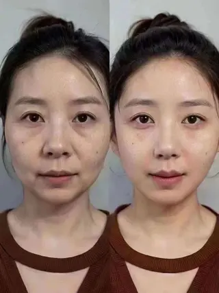 マツエク・マツパ aliaハイフ&水光ジェットサロン所属・aliaハーブ水光店 エステティシャン募集のエステ・リラクイメージ