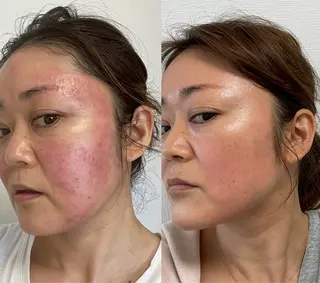 ARLY’S KAORIのエステ・リラクイメージ