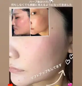 FLEUR 2号店のエステ・リラクイメージ