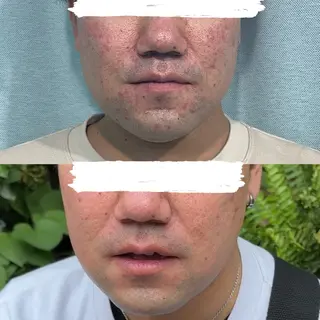 よもぎ蒸しサロン ruiangeのエステ・リラクイメージ