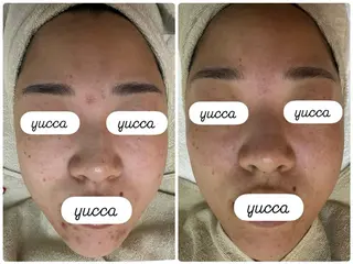 シミ毛穴専門店 yucca(ユッカ)のエステ・リラクイメージ