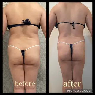 MARISS beautysalon所属・MARISS beauty高尾のエステ・リラクイメージ