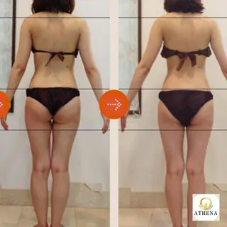 アテナ池袋西口店 中野（ナカノ）のエステ・リラクイメージ