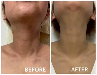 夜限定SARON 💎YISM💎のエステ・リラクイメージ