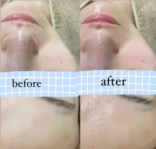 RE:moom リムーム/脱毛エステのエステ・リラクイメージ