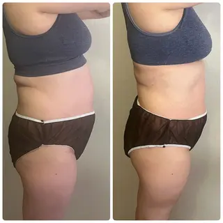 アロマ･美容鍼･カッ ピング「麗」鍼灸院のエステ・リラクイメージ