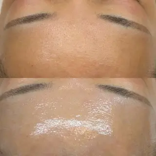 韓国🇰🇷価格 サロン_Nbibiのエステ・リラクイメージ