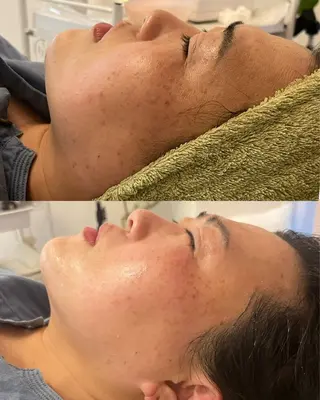 金の糸脱毛 産毛ケア専門のエステ・リラクイメージ