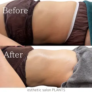 esthetic salon PLANTS所属・エステティックサロン PLANTSのエステ・リラクイメージ