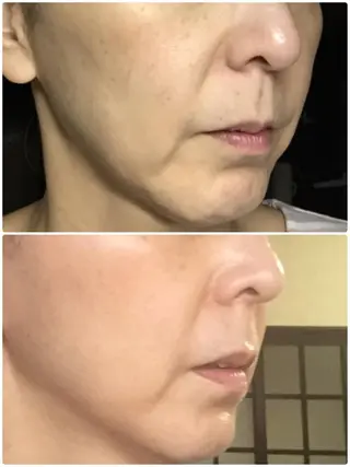 ビューティースタジオ DEWのエステ・リラクイメージ