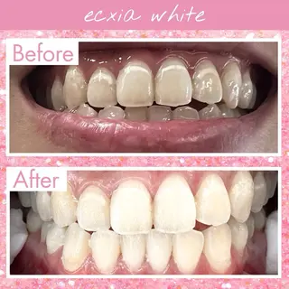 セルフホワイトニング エクシア西宮北口店所属・セルフホワイトニング エクシア西宮北口店のその他イメージ