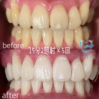 メンズ マツエク・マツパ アイブロウ ホワイトニング ⚓︎CREW柏⚓︎のその他イメージ