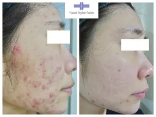 肌質改善専門サロン ／FSS渋谷店　松本のエステ・リラクイメージ