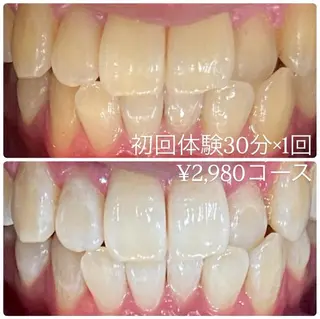 メンズ ホワイトニングルーム　川崎店所属・ホワイトニング ルーム　川崎店のその他イメージ