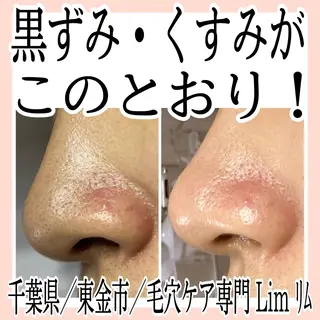 Lim Naomiのマツエク・マツパデザイン