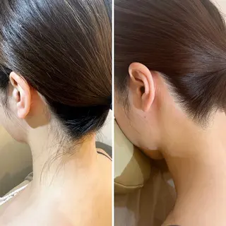 うなじ脱毛/美肌脱毛 LABELのエステ・リラクイメージ