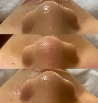 AKALA hitomiのエステ・リラクイメージ