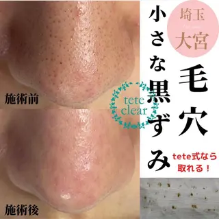 private salon  Dea_maris シュガーリング＆パーソナルボディケア所属・シミ改善・韓国肌管理 ボディメイク痩身のその他イメージ