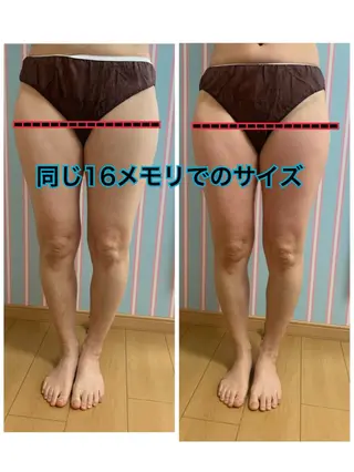 痩身/脱毛/ネイル HARUKAのエステ・リラクイメージ