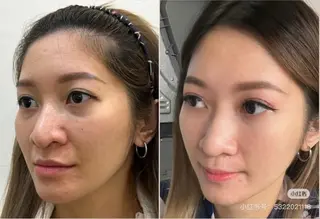 カラー aliaハイフ&水光ジェットサロン所属・aliaハーブ水光店 エステティシャン募集のエステ・リラクイメージ