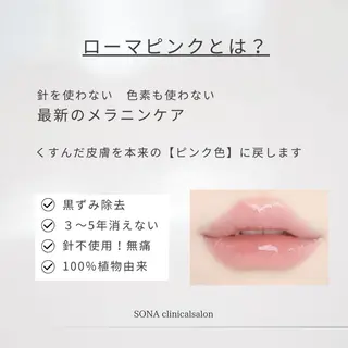 小顔/たるみ/黒ずみ除去専門サロン/SONA 大和西大寺店所属・【小顔専門看護師 サロンSONA】のエステ・リラクイメージ