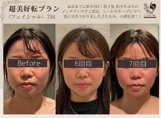 総合美容サロン LOVEME渋谷本店のエステ・リラクイメージ